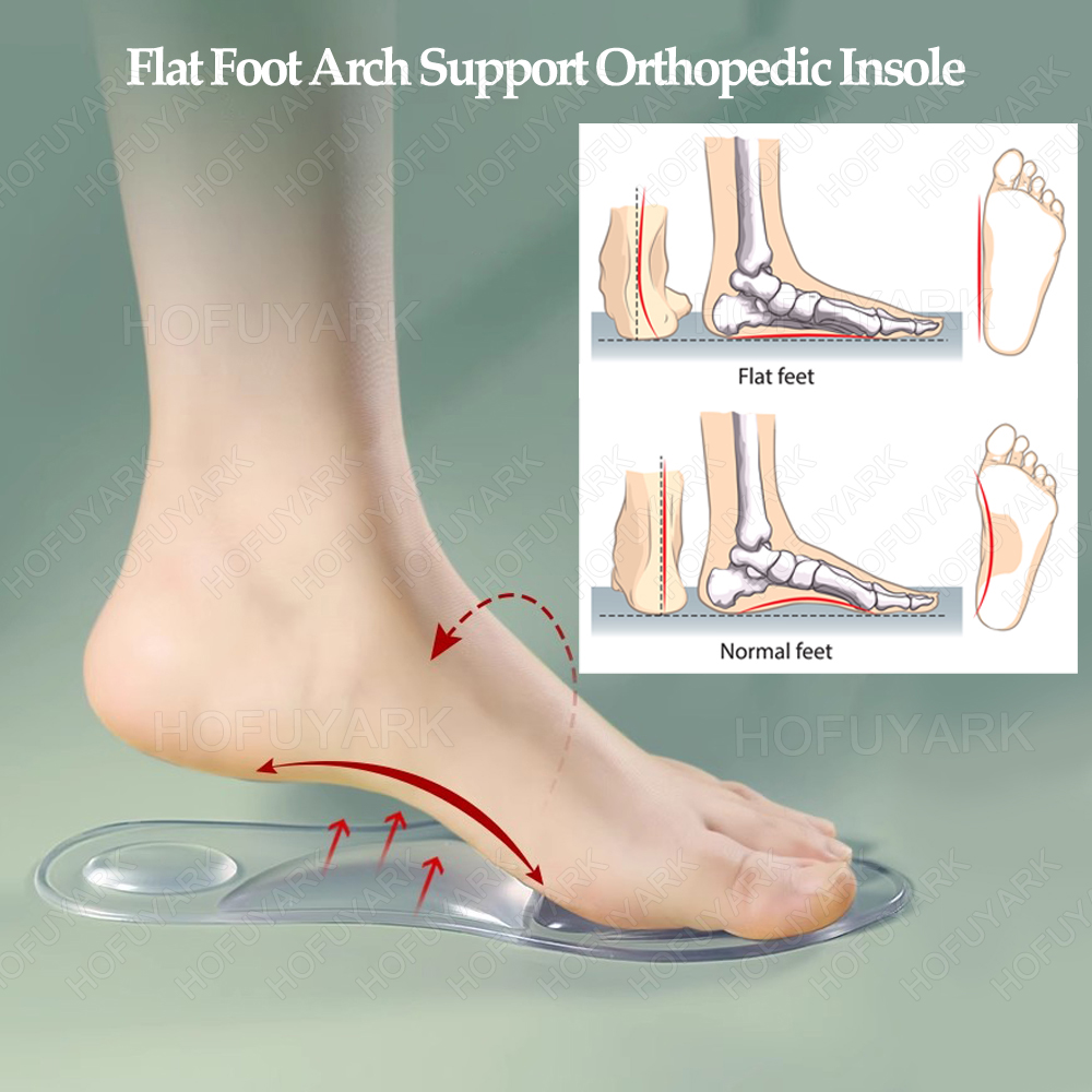 Silicone Gel Insoles Orthopedi - огляд і ціна Women'S Shoes High Arch Support